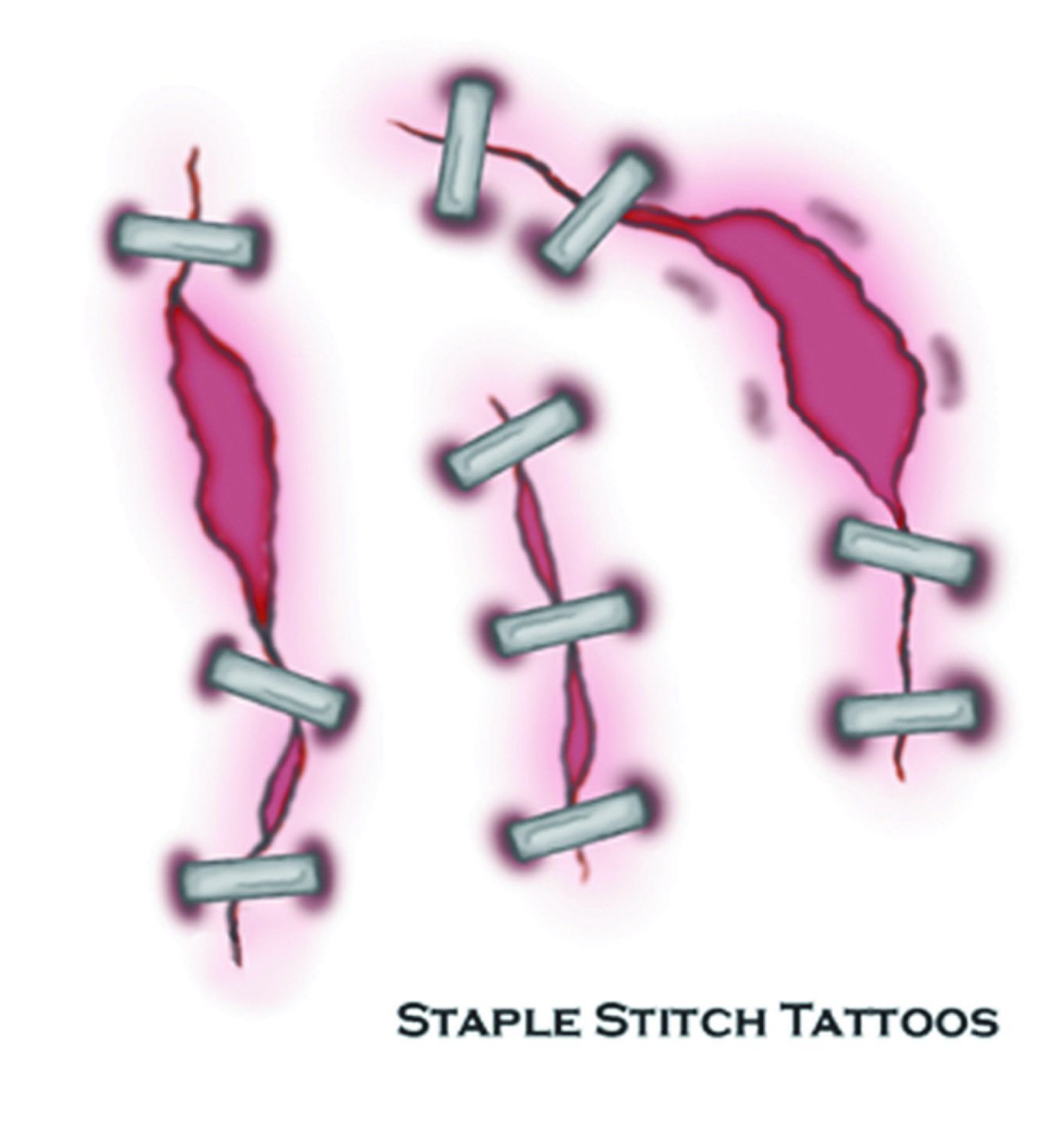 tattoo-staple-stitch-fx-50.png